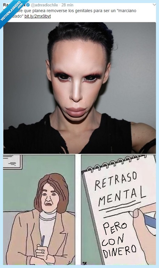 salir,retraso,mental