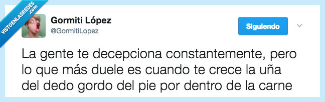 decepción,constante,uña