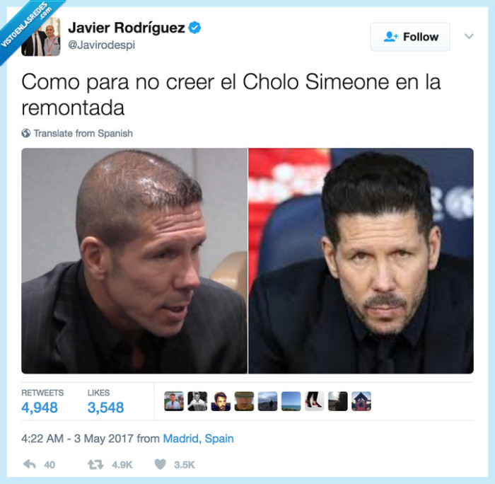 simeone,pelo,calvo