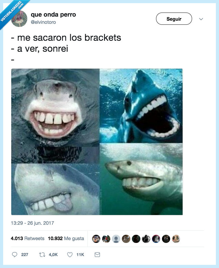 brackets,sacar,sonreír