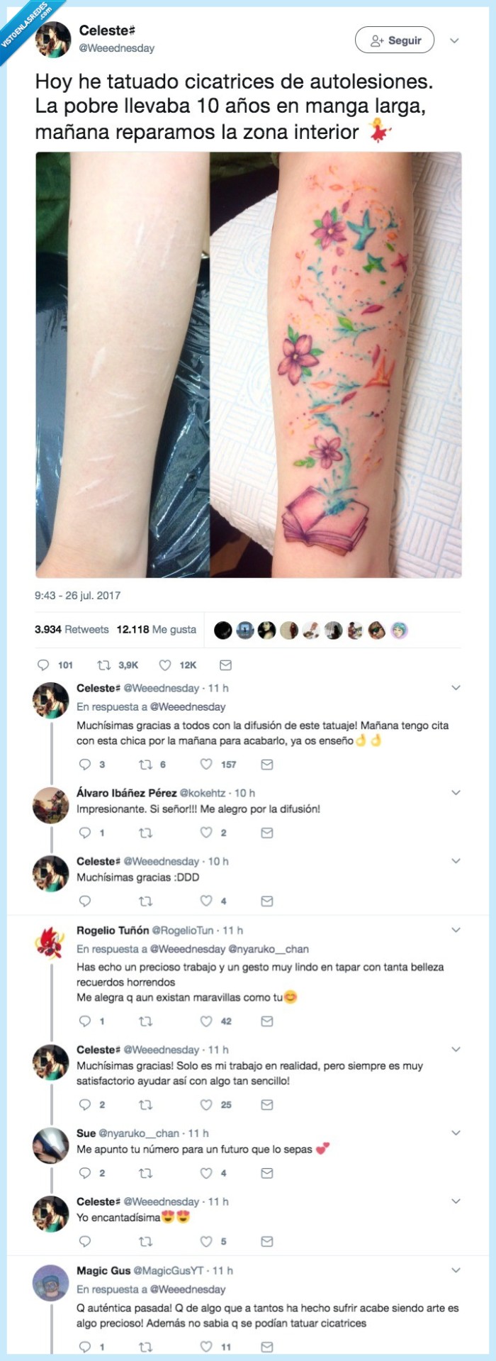 tatuaje,heridas,autolesión