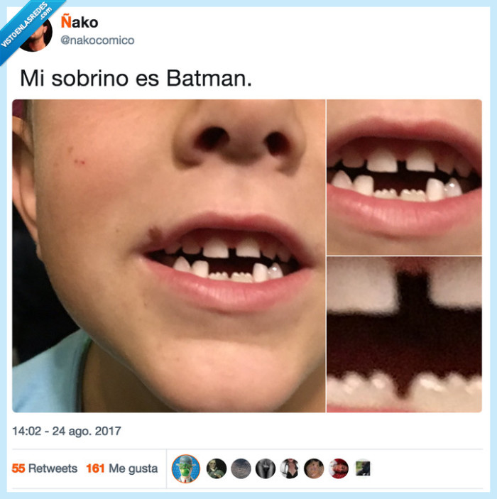 dientes,salir,sobrino