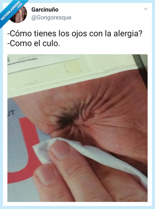 resfriado,ojete,ojos