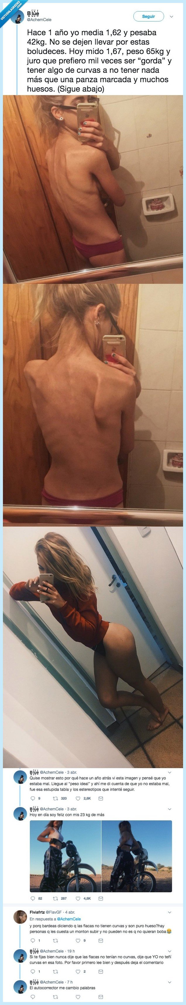 485875 - Comparte sus fotos de antes y después de superar su anorexia y no nos podemos alegrar más por ella