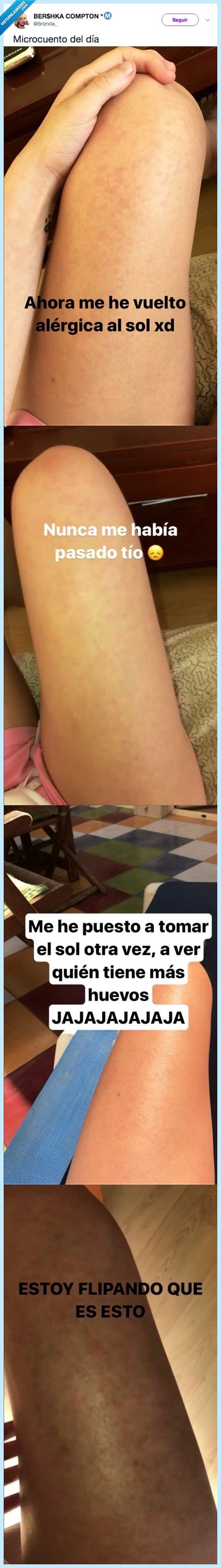 alergia,sol,inteligencia