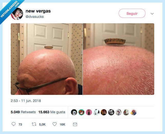 489758 - No eres totalmente calvo si..., por @dvasucks