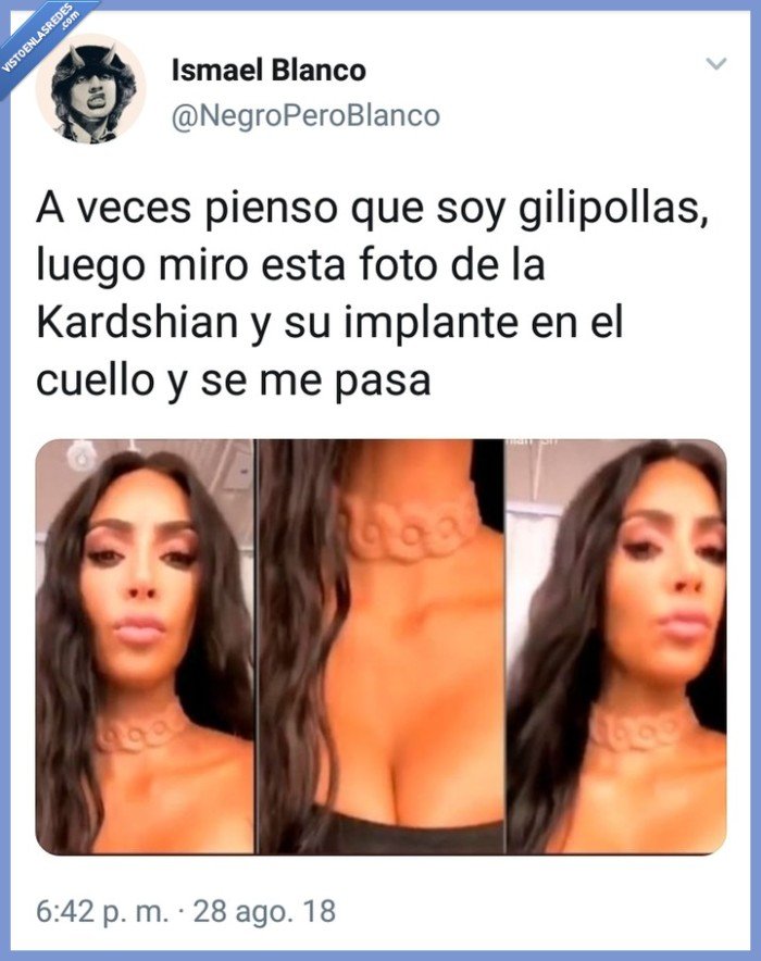 Kardashian,collar,implante