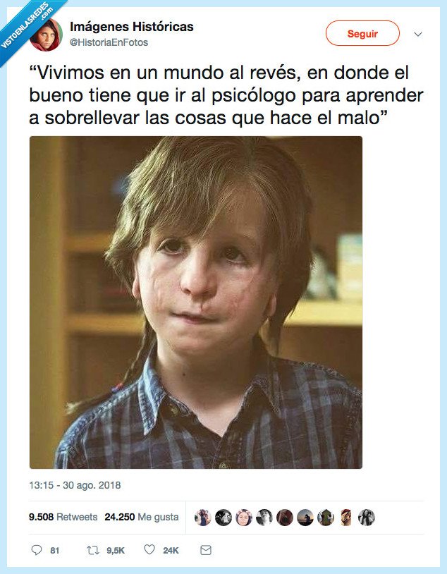 495221 - Una lección que nos da Wonder, por @HistoriaEnFotos