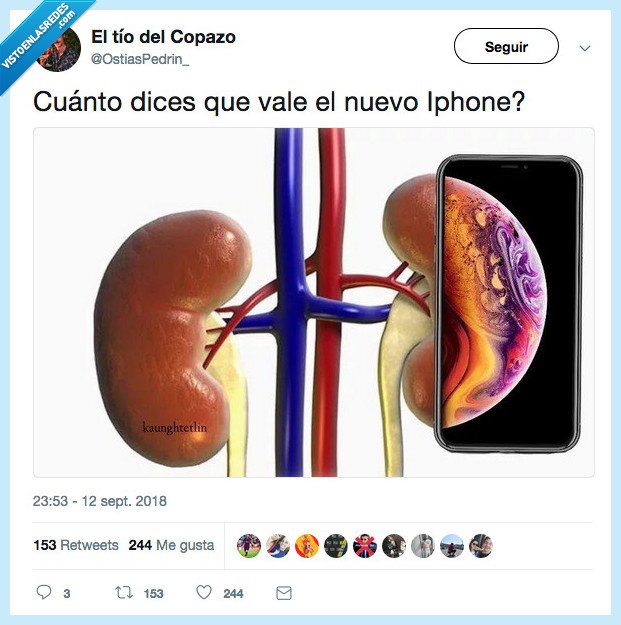 riñón,iphone,dolor