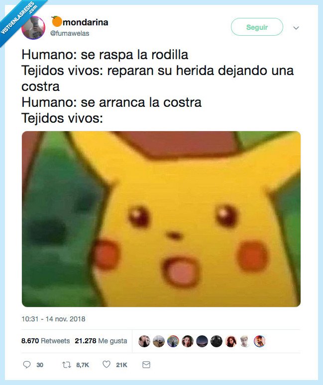 representar,fuerte,humano,raspar