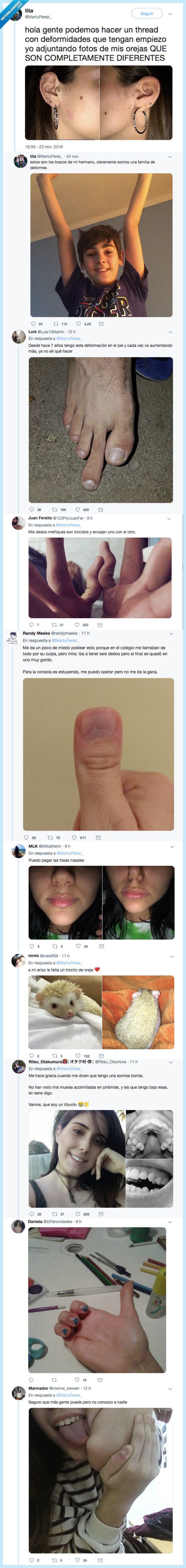 compartir,deformidades,?¿?¿?¿?