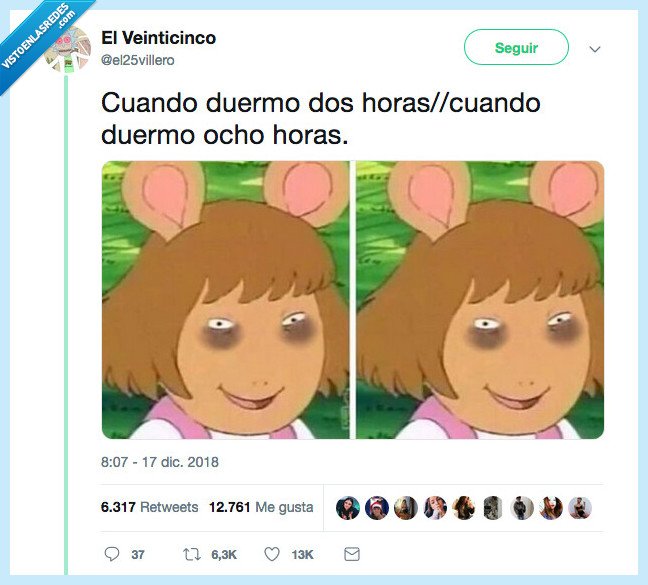 ojeras,tapar,dormir,horas