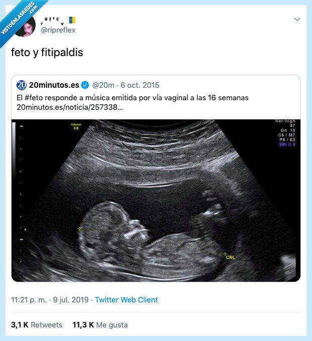 gustar,grupo,musico,más pequeños,fito fitipaldis