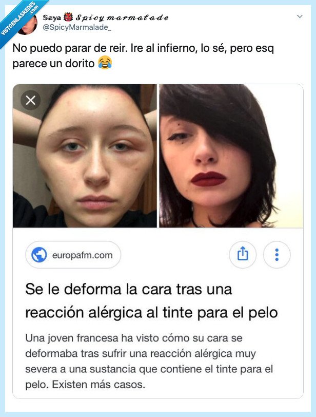 doritos,tinte,reaccion,inflamado,hinchado,chica,cara