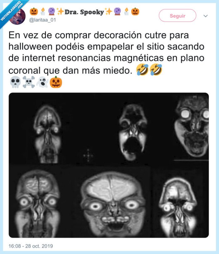 radiografía,halloween,plano coronal