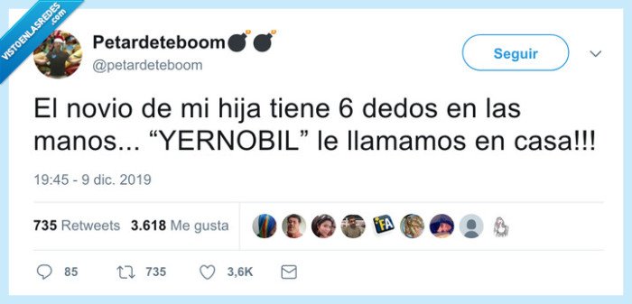 dedos,yerno,chernobyl