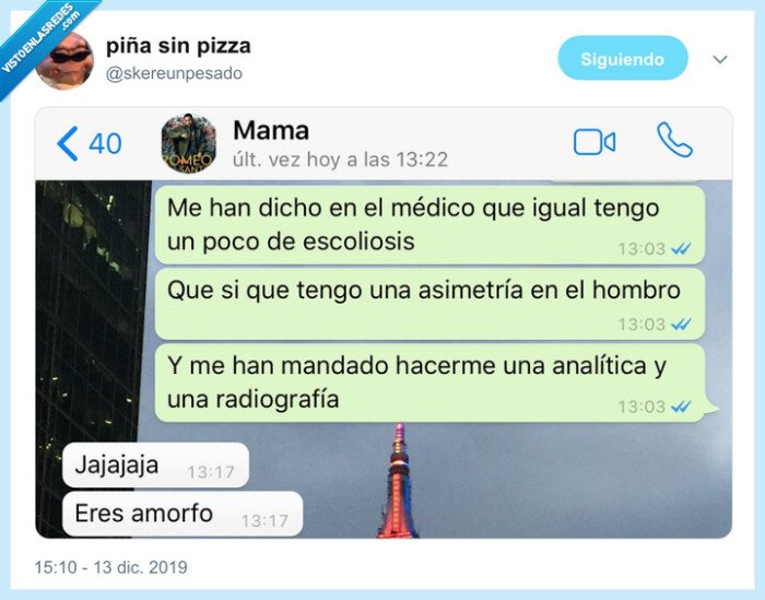 madre,amorfo,escoliosis