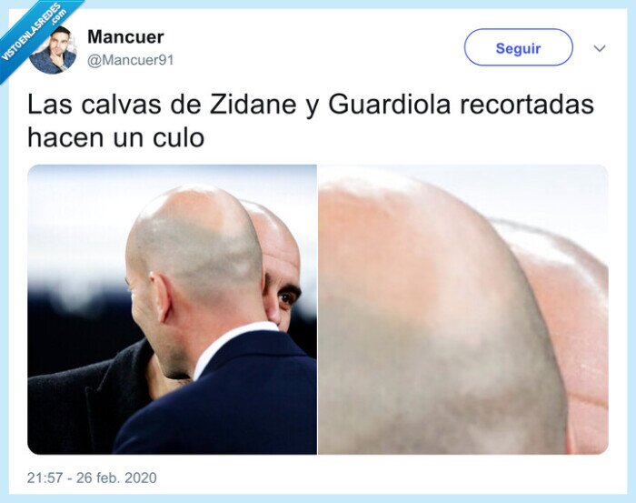 calvas,calvo,zidane,guardiola,trasero