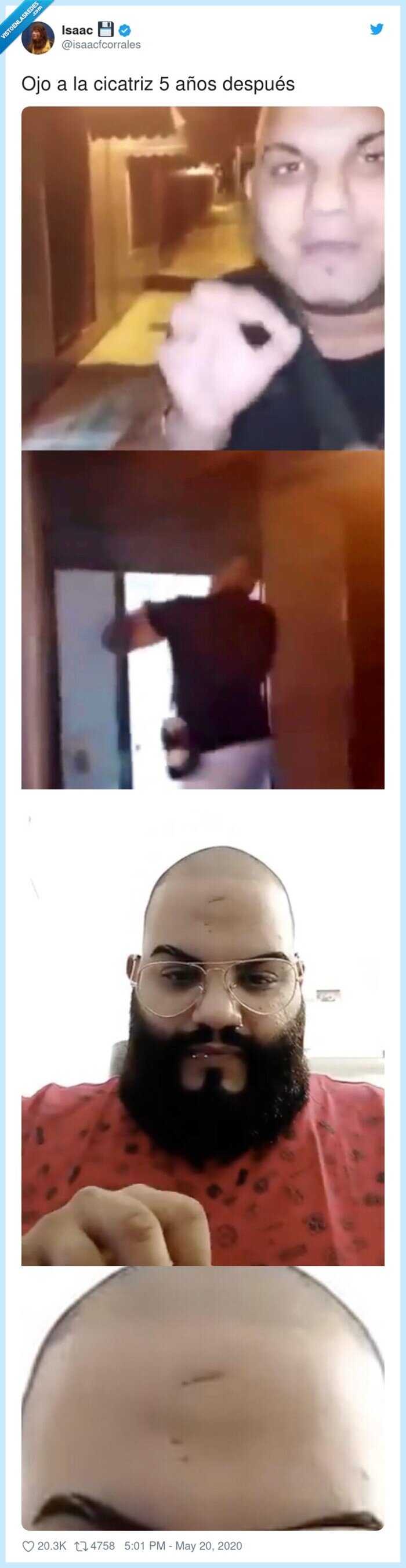 cicatriz,después,años,ojo,hostiazo,puerta,persiana