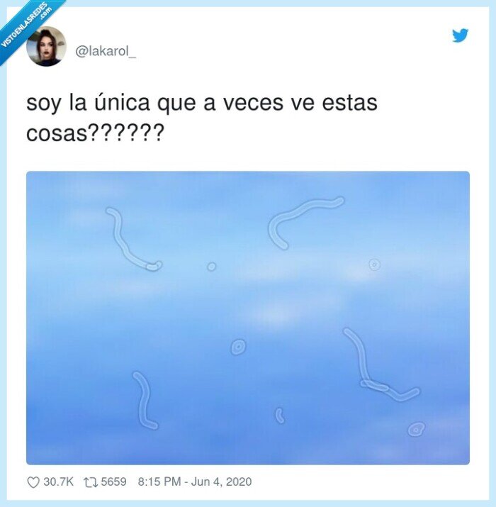 visión,ojos,alucinación,Miodesopsias