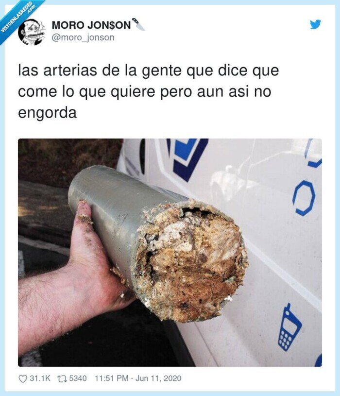 arterias,engordar,gente