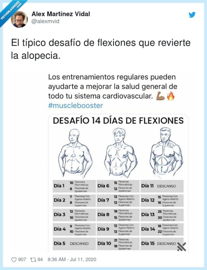 flexiones,desafío,revierte,alopecia,típico,que