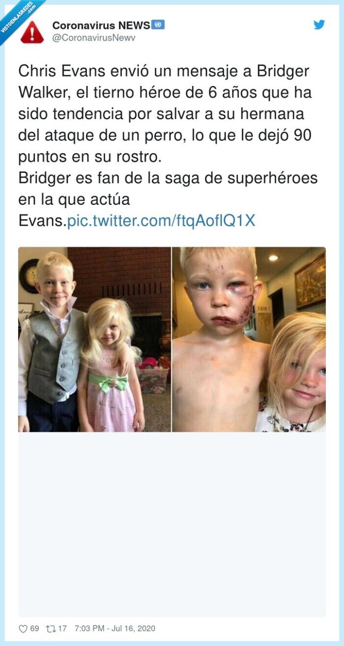 632189 - Emotivo mensaje del Capitán América (con regalo incluido) a un niño de 6 años que recibió 90 puntos en la cara por salvar a su hermanita del ataque de un perro