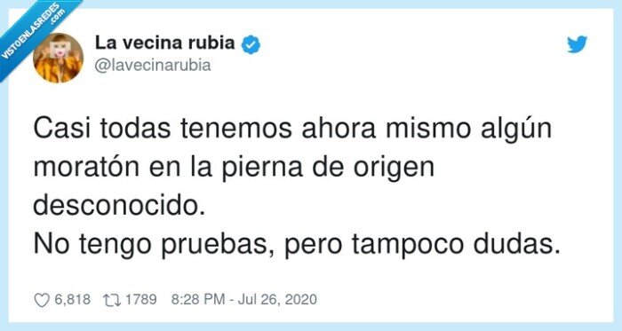 desconocido,moratón,pruebas,tenemos,piernas
