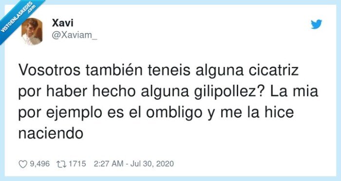 cicatriz,ombligo,nacer,vivir