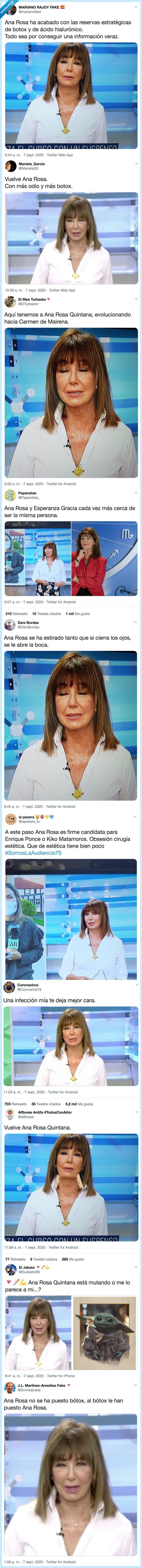 bótox,puesto,ana rosa quintana,cara,omg