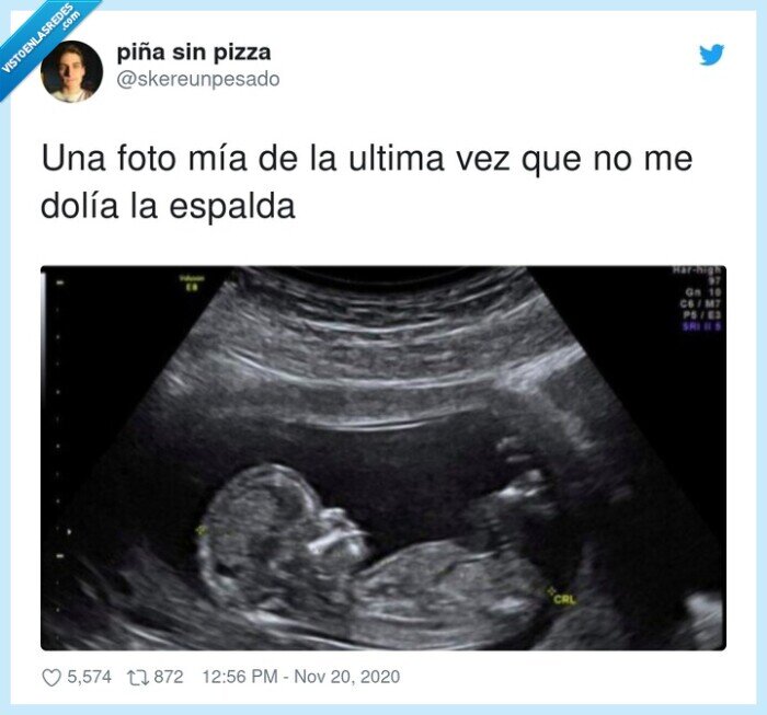 espalda,dolía,ultima,foto