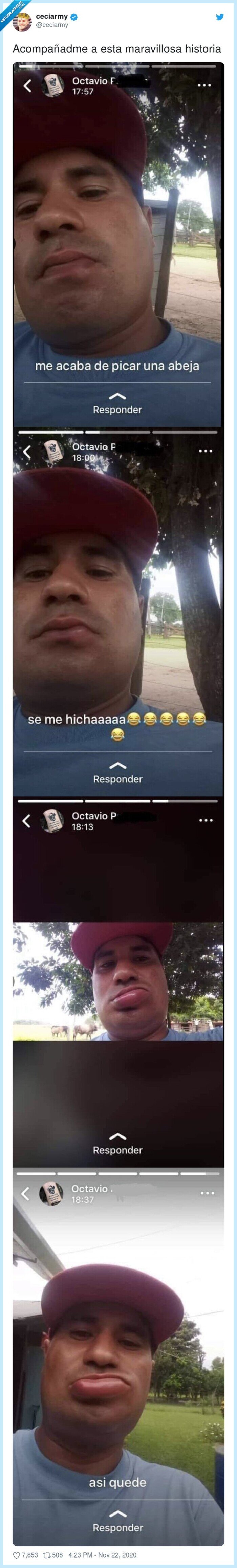 picar,labios,hinchados