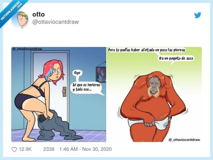 invierno,pelos,depilación