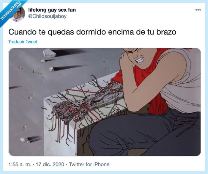 brazo,dormido,encima