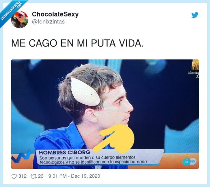 ciborg,tecnologia,nerds