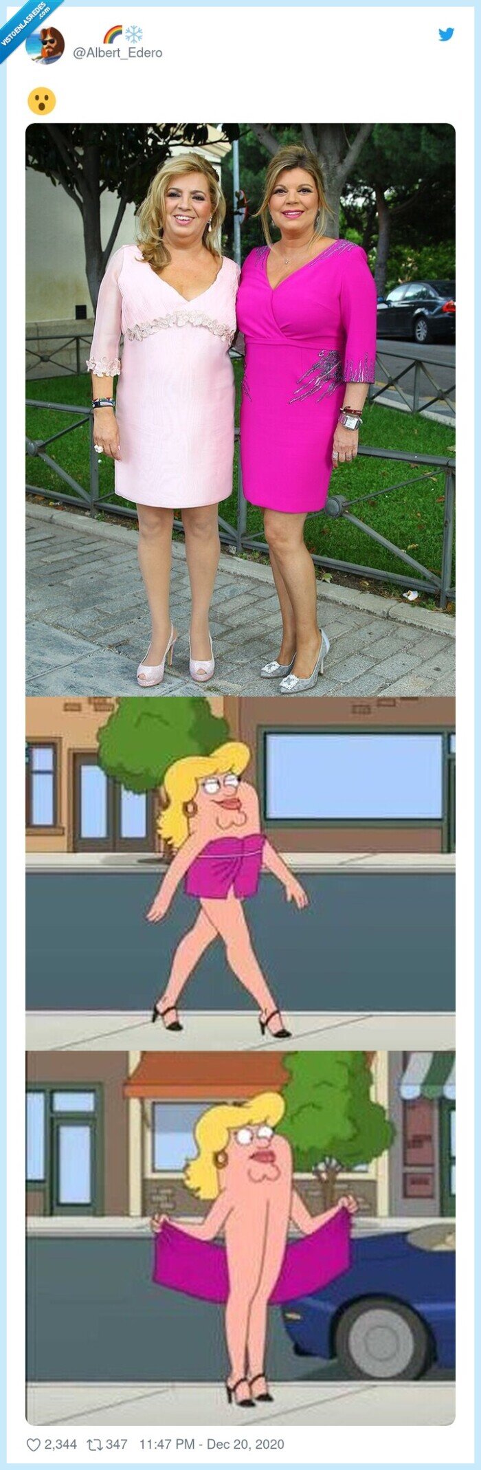 campos,terelu,cuerpo deforme