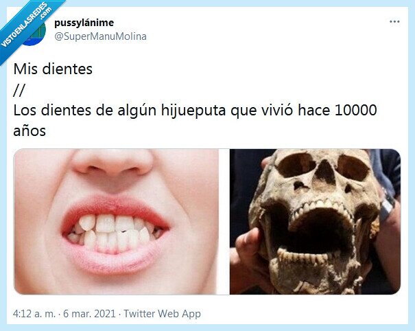 dientes,torcido,perfectos