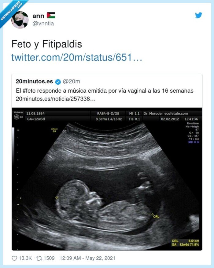 fitipaldis,feto,fiti