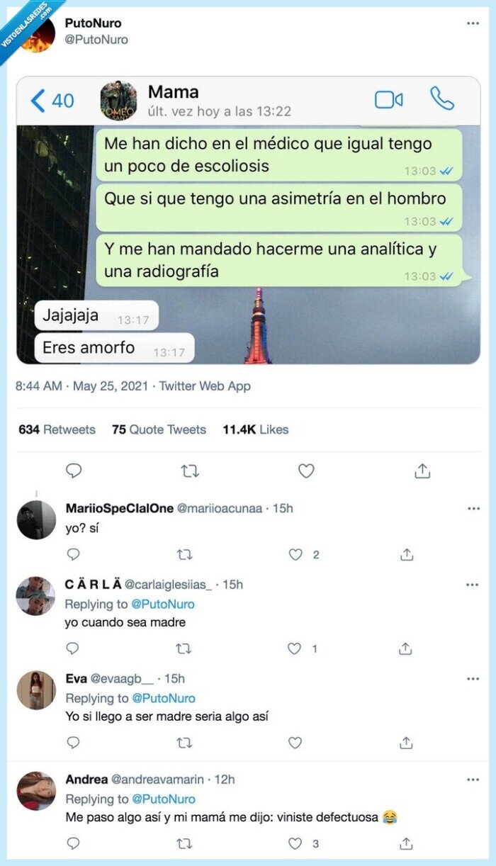 madre,escoliosis,desviación,amorfo