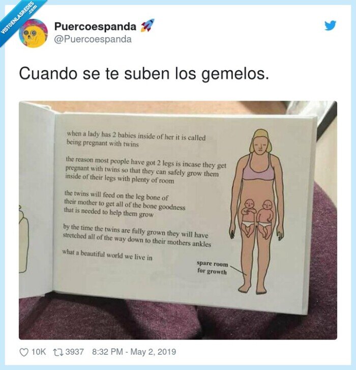 gemelos,subir,pierna