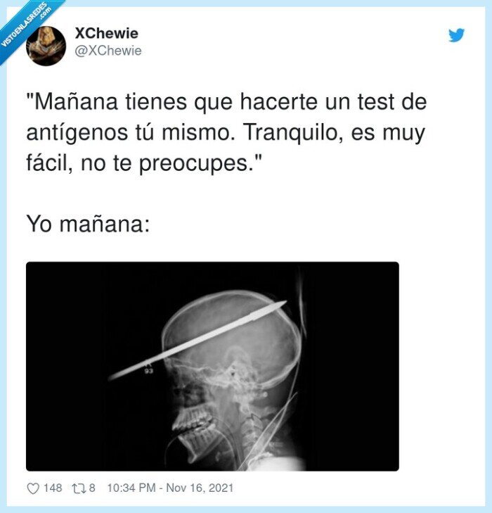 tranquilo,antígenos,test,coronavirus,clavarse,cerebro