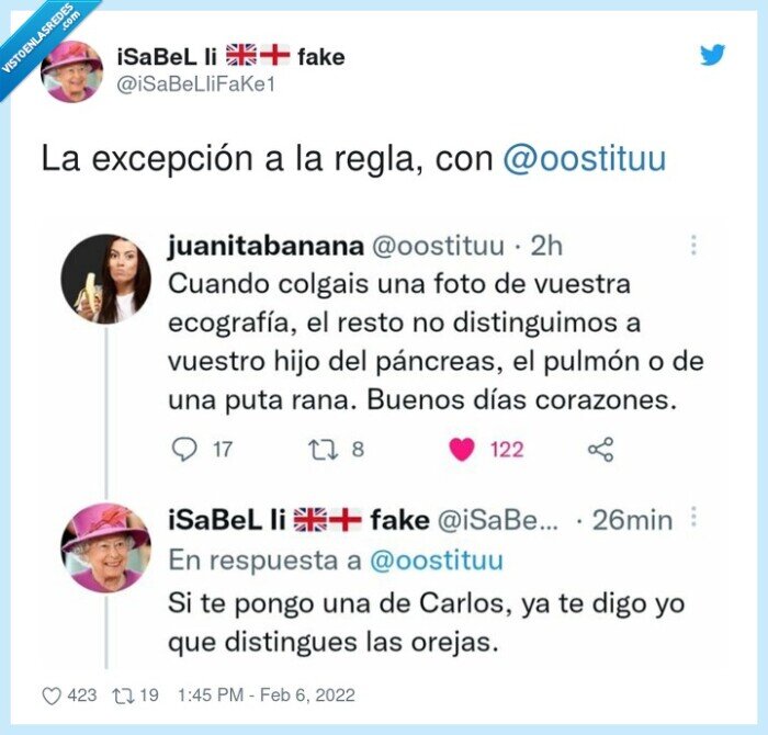excepción,ecografía,feto,oreja,carlos de inglaterra