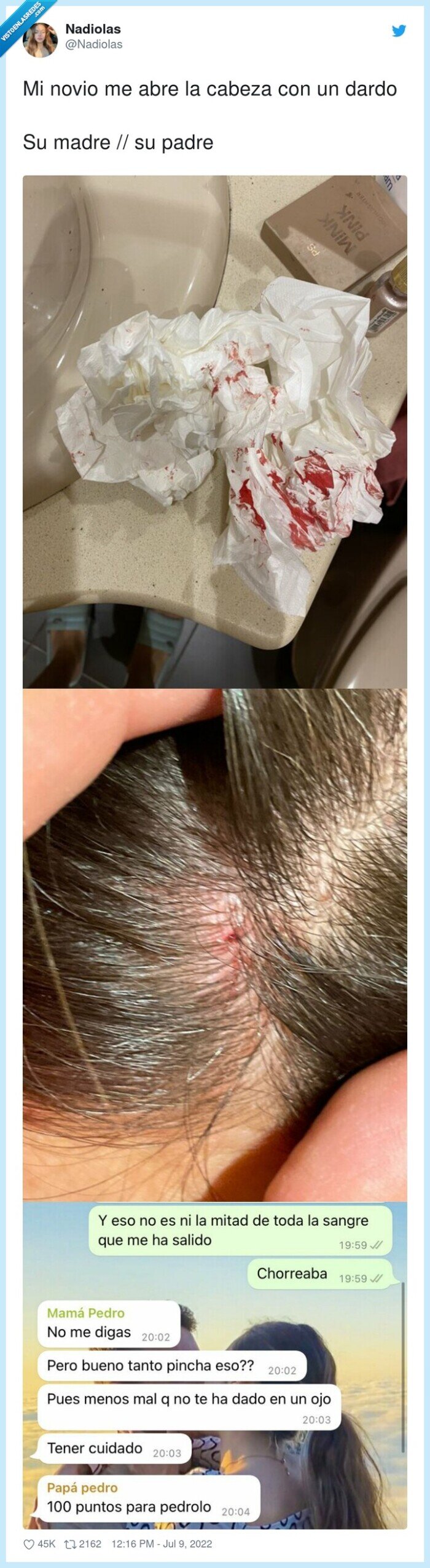 cabeza,novio,dardo,madre,padre,abre