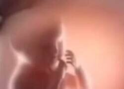 Enlace a Cuando naces francés y te arrepientes, por @galiindo13