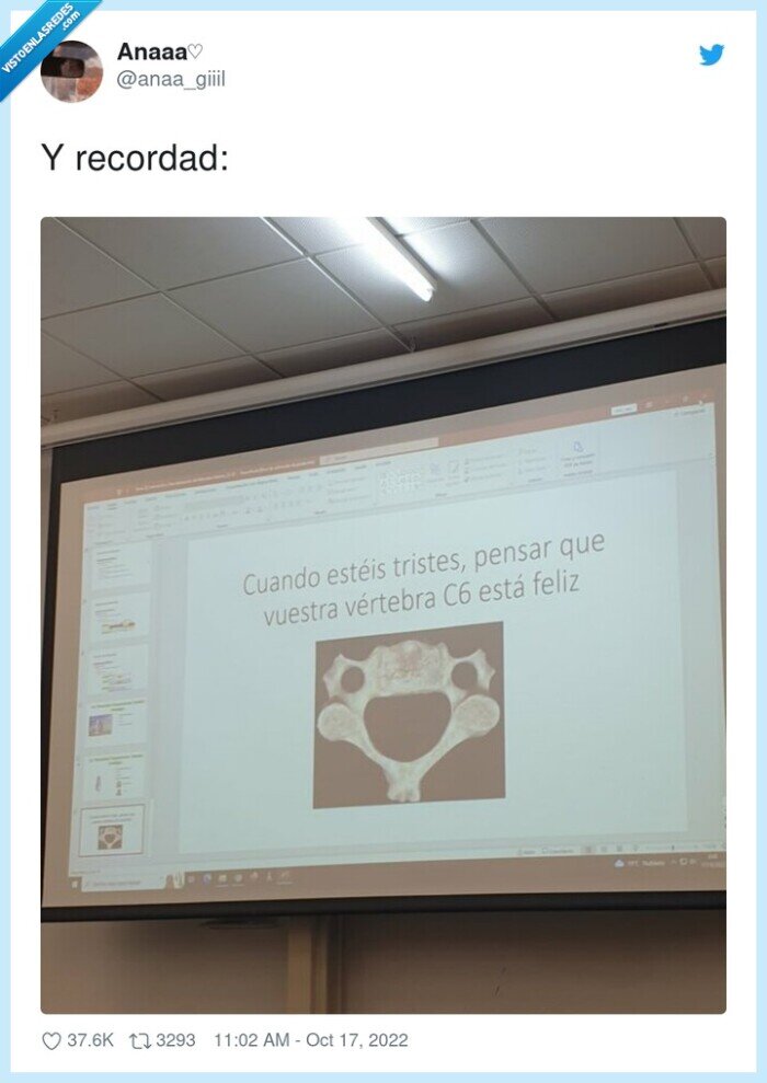 vértebra,feliz,risa,cara