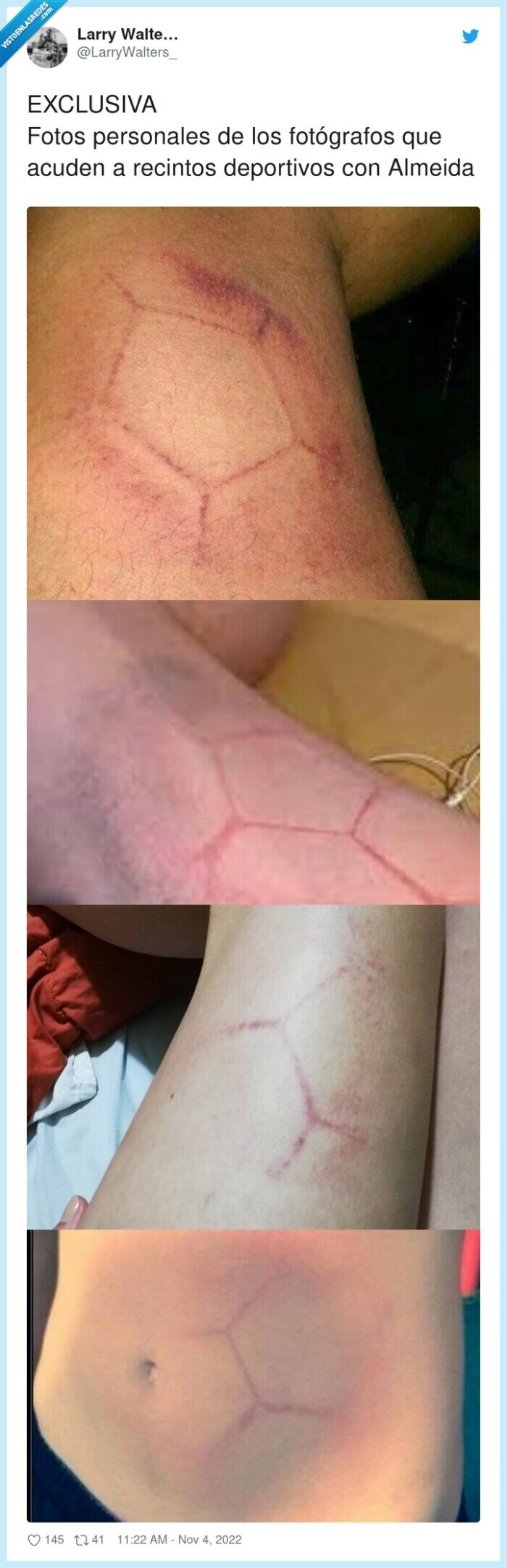 exclusiva,fotógrafos,deportivos,pelotazo,patoso,almeida