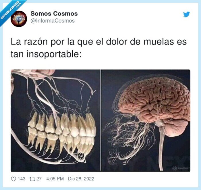 insoportable,razón,muelas,dolor