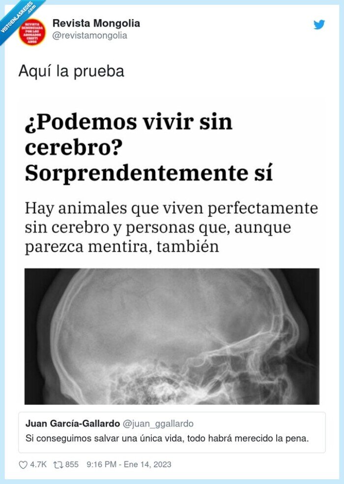 cerebro,vivir,sin