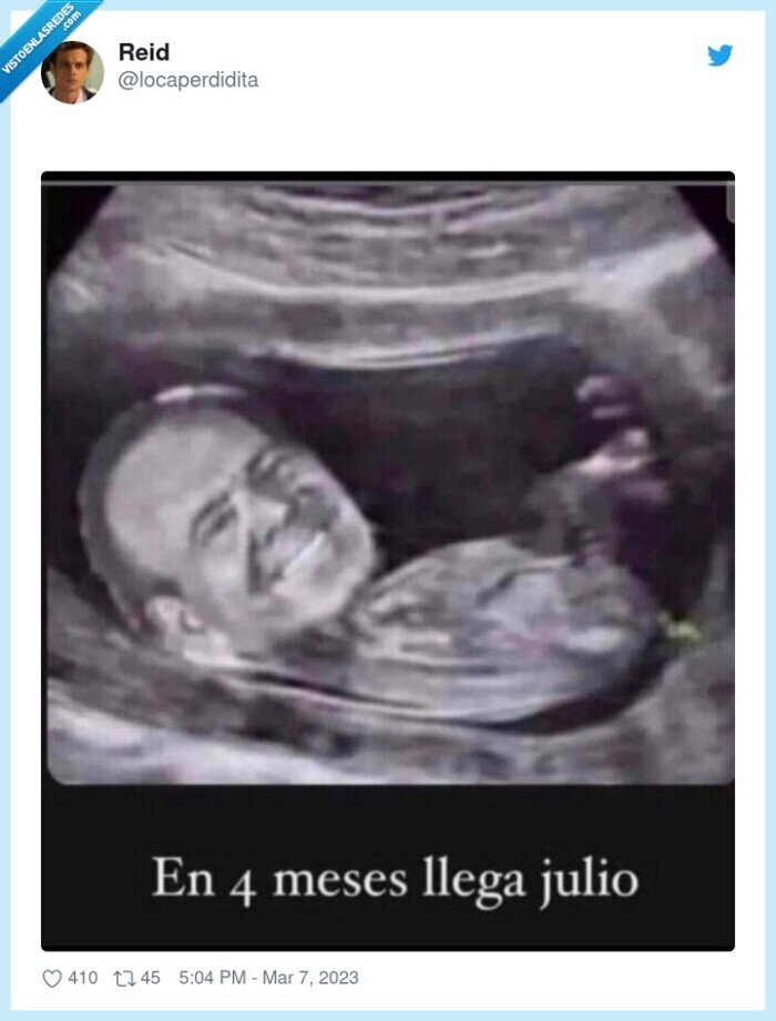 julio iglesias,ecografía,se viene