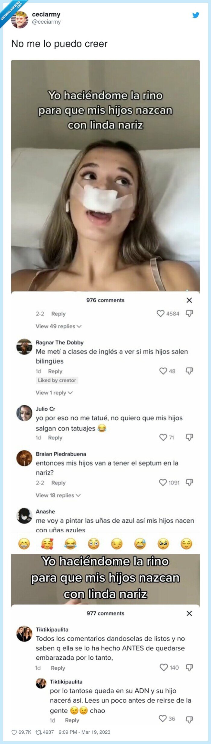 rinoplastia,nariz,heredar,genética,comentarios